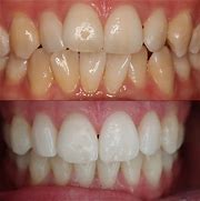 Teeth whitening dental clinic