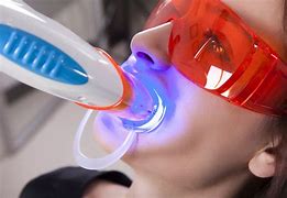 Teeth whitening dental clinic