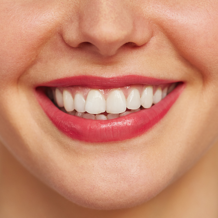 Dental Treatment Before After