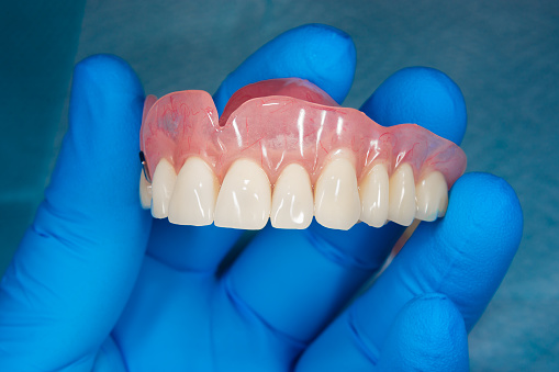 Denture Treatment In Vadodara| Vraj Dental Clinic